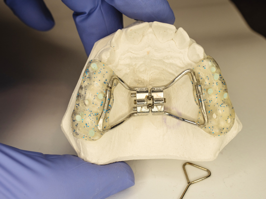 When And Why Expanders Are Recommended By Orthodontists